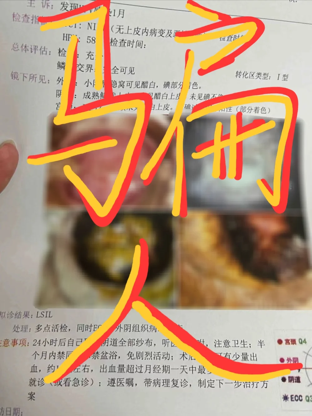 私立妇科医院套路深？教你有效维权！💡,国内供卵生子的费用-国内代怀孕价格表